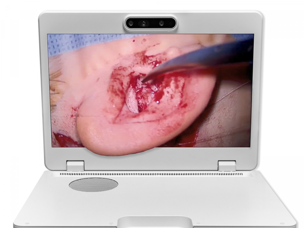 达擎之＂Heads-up 3D显微手术显示系统＂，整合4K裸眼3D显示及眼球追踪系统，具备快速追踪人眼移动位置功能，减轻医师长时间维持固定姿势的负担，让医师能有更宽广清晰的3D立体视野及更舒适的姿势来执行手术。